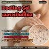 CM3970 รับผลิตPeeling Gel รับผลิตเจลระเบิดขี้ไคล